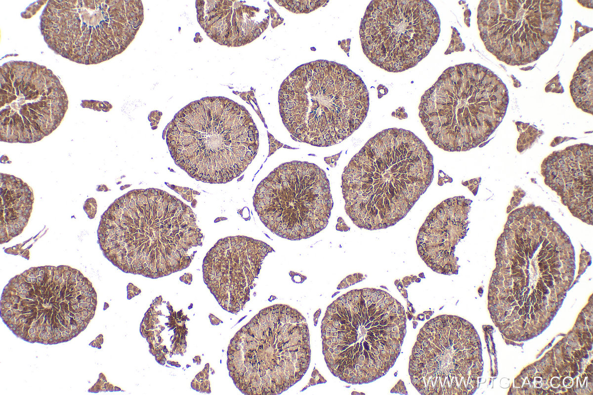 IHC staining of mouse testis using 11645-1-AP IHC staining of mouse testis using 11645-1-AP