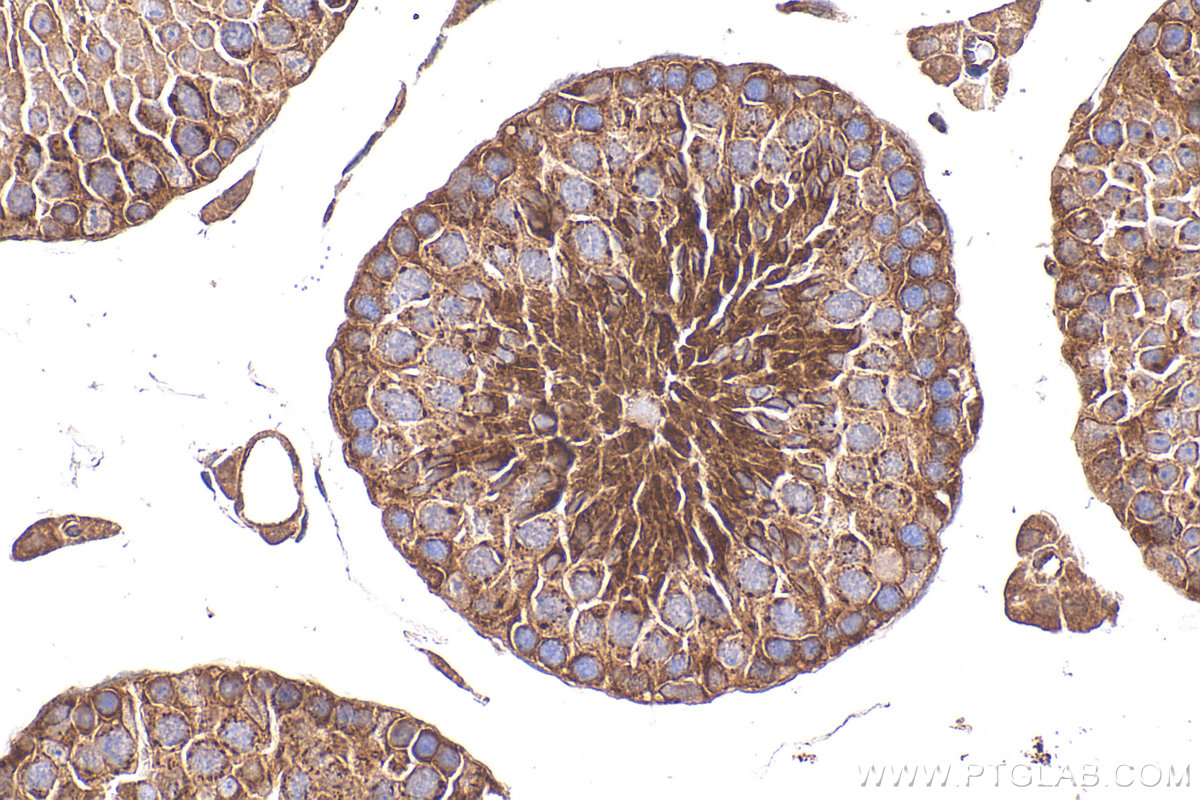 IHC staining of mouse testis using 11645-1-AP IHC staining of mouse testis using 11645-1-AP
