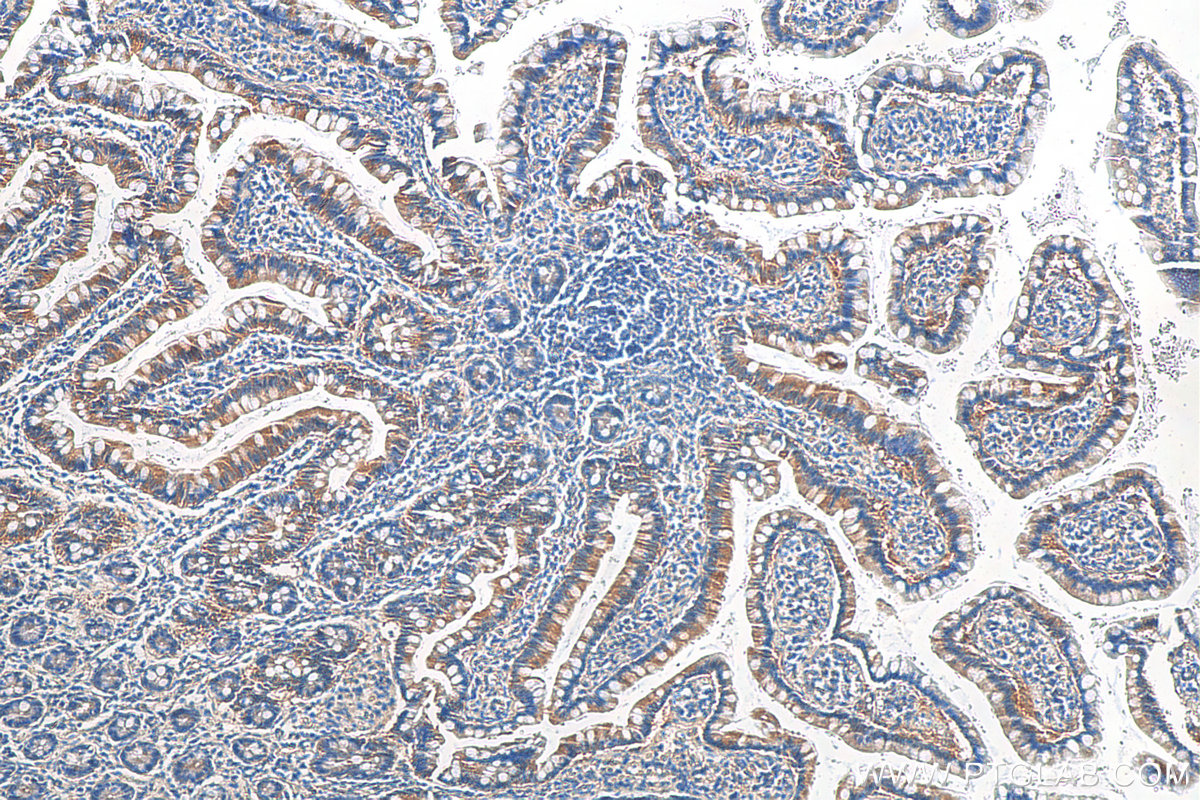 IHC staining of human small intestine using 16493-1-AP