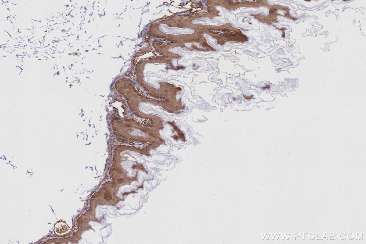 IHC staining of mouse stomach using 16493-1-AP IHC staining of mouse stomach using 16493-1-AP
