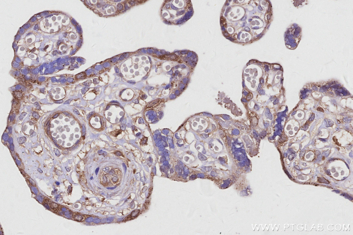 IHC staining of human placenta using 16493-1-AP IHC staining of human placenta using 16493-1-AP