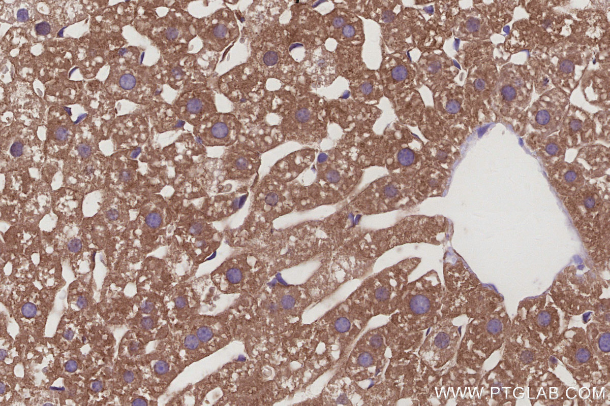 IHC staining of mouse liver using 16493-1-AP IHC staining of mouse liver using 16493-1-AP