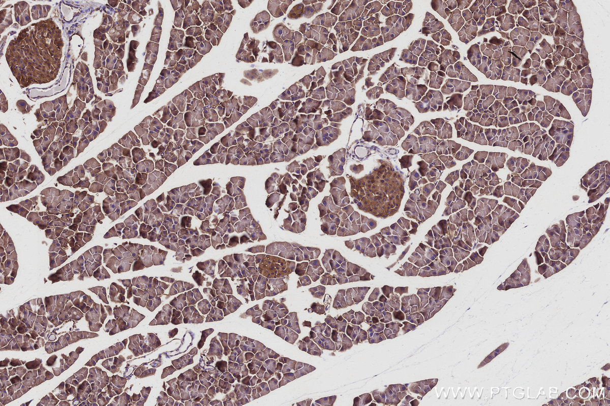 IHC staining of mouse pancreas using 16493-1-AP IHC staining of mouse pancreas using 16493-1-AP