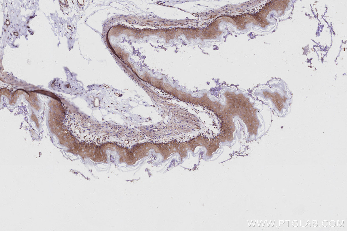 IHC staining of rat stomach using 16493-1-AP IHC staining of rat stomach using 16493-1-AP