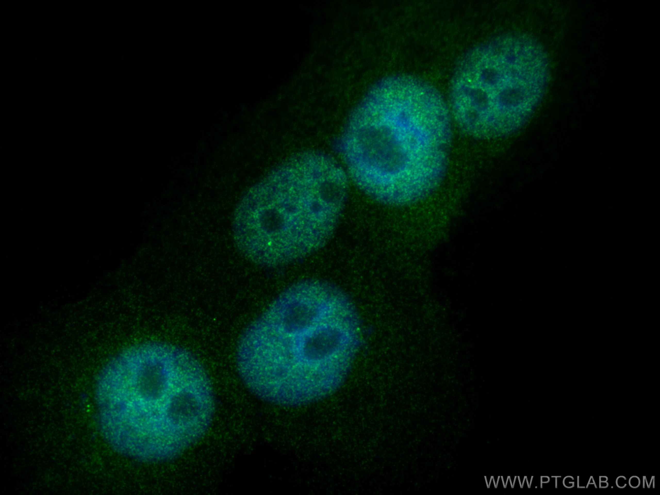 IF Staining of A431 using 18887-1-AP