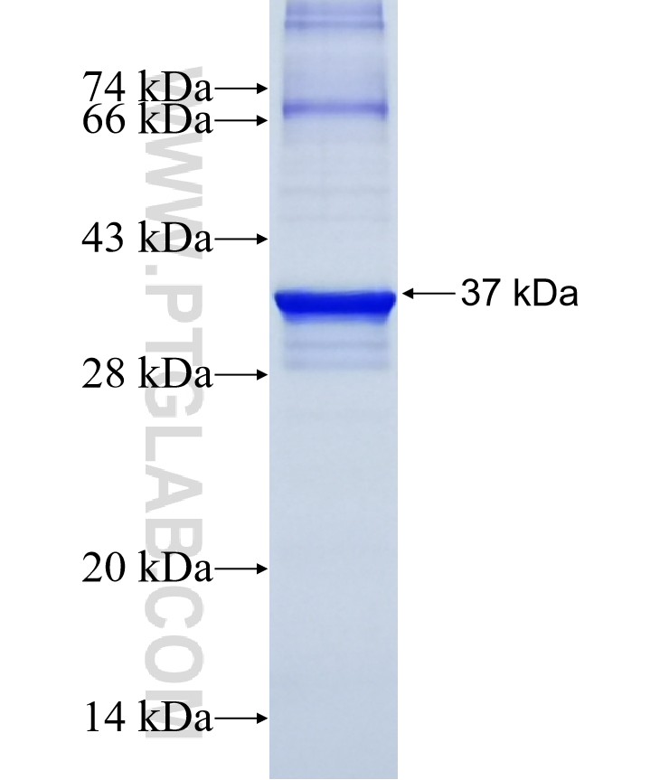 KLF1 fusion protein Ag13467 SDS-PAGE