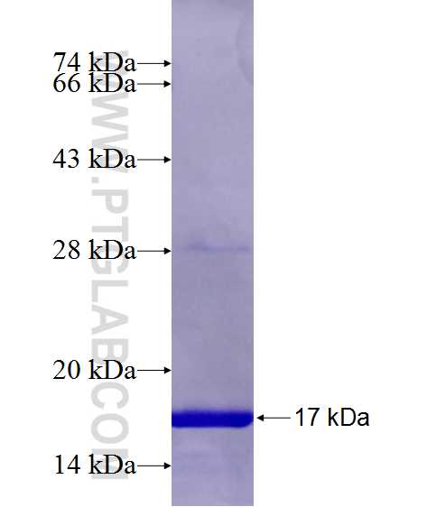 KLF1 fusion protein Ag13469 SDS-PAGE KLF1 fusion protein Ag13469 SDS-PAGE