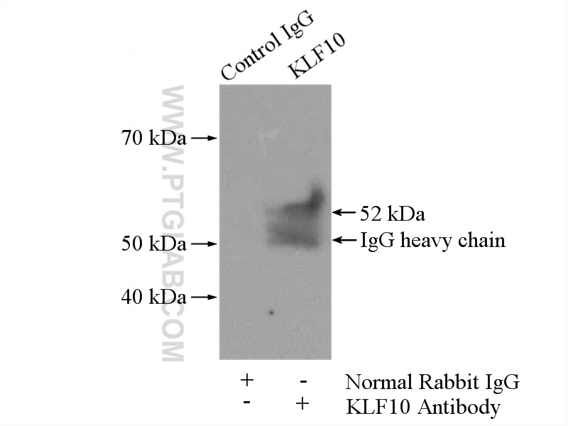 IP experiment of Jurkat using 11881-1-AP