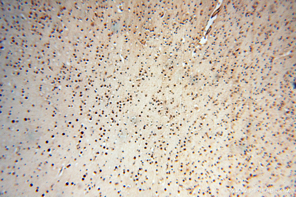 IHC staining of human brain using 18352-1-AP