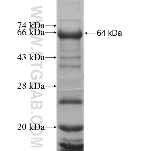 KLF17 fusion protein Ag11800 SDS-PAGE KLF17 fusion protein Ag11800 SDS-PAGE