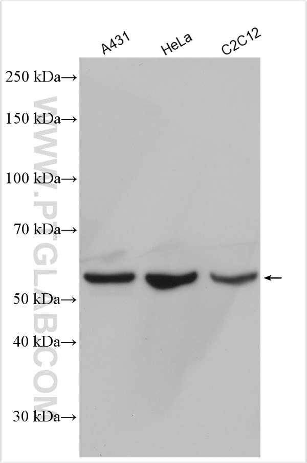 WB analysis using 11880-1-AP