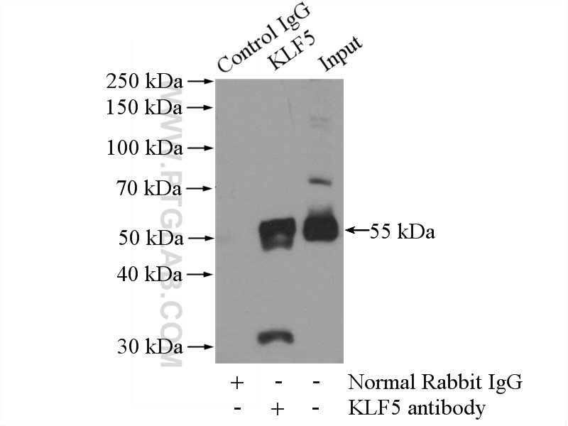 IP experiment of HeLa using 21017-1-AP