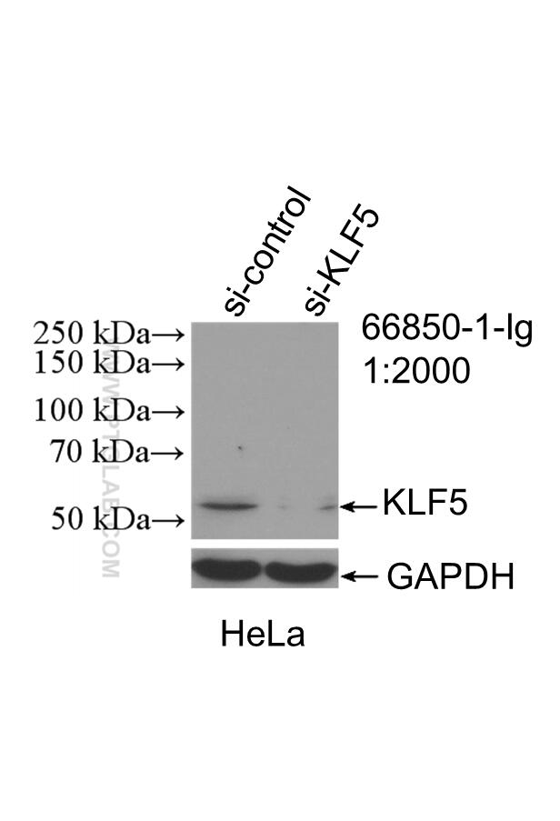 WB analysis of HeLa using 66850-1-Ig