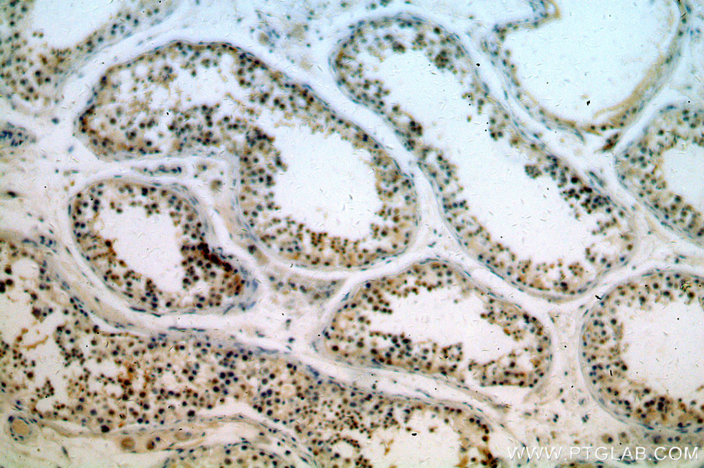 IHC staining of human testis using 14716-1-AP