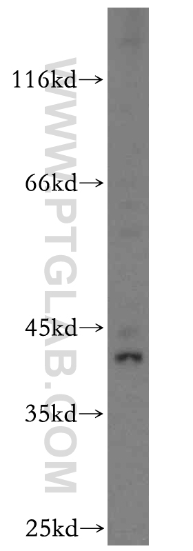KLF6 Polyclonal antibody