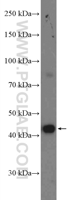 HeLa cells were subjected to SDS PAGE followed by western blot with 27277-1-AP (KLHDC1 Antibody) at dilution of 1:1000 incubated at room temperature for 1.5 hours. WB analysis of HeLa using 27277-1-AP
