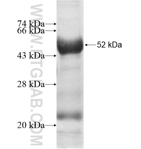 KLHDC2 fusion protein Ag10951 SDS-PAGE KLHDC2 fusion protein Ag10951 SDS-PAGE