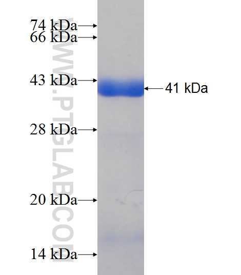 KLHDC4 fusion protein Ag9254 SDS-PAGE KLHDC4 fusion protein Ag9254 SDS-PAGE