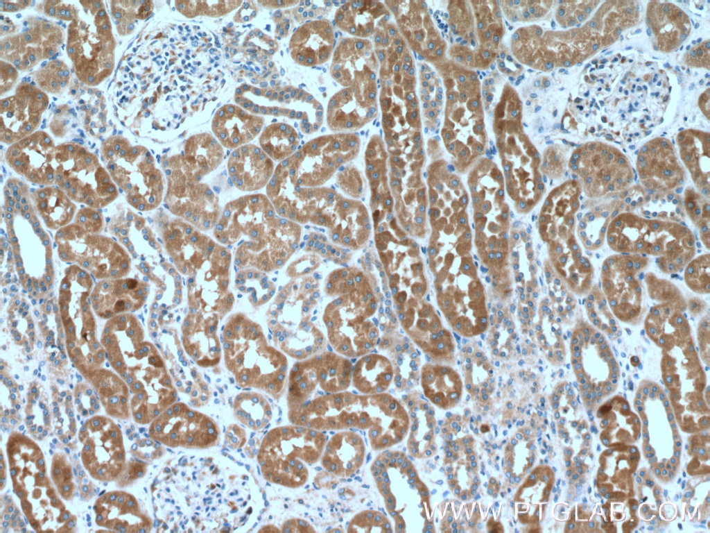 IHC staining of human kidney using 24847-1-AP