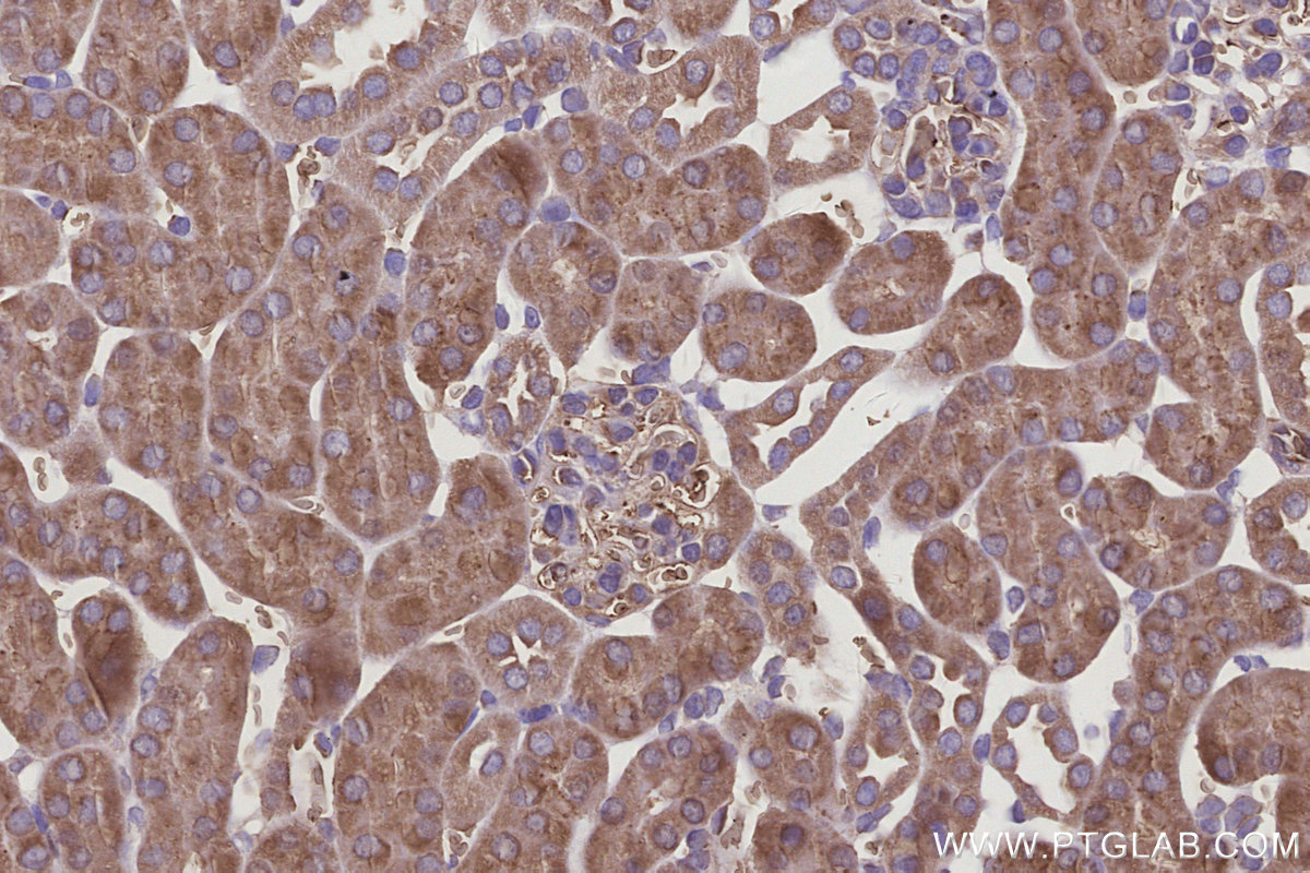 IHC staining of mouse kidney using 24847-1-AP IHC staining of mouse kidney using 24847-1-AP