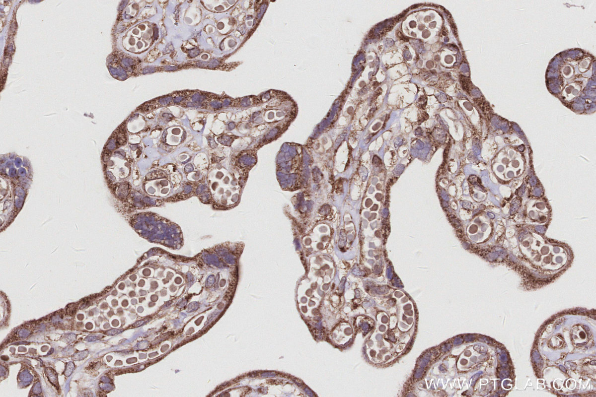 IHC staining of human placenta using 24847-1-AP IHC staining of human placenta using 24847-1-AP