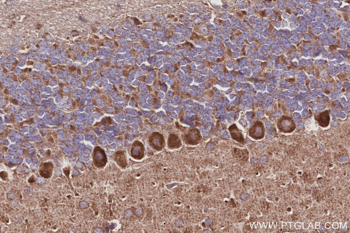 IHC staining of mouse cerebellum using 24847-1-AP IHC staining of mouse cerebellum using 24847-1-AP