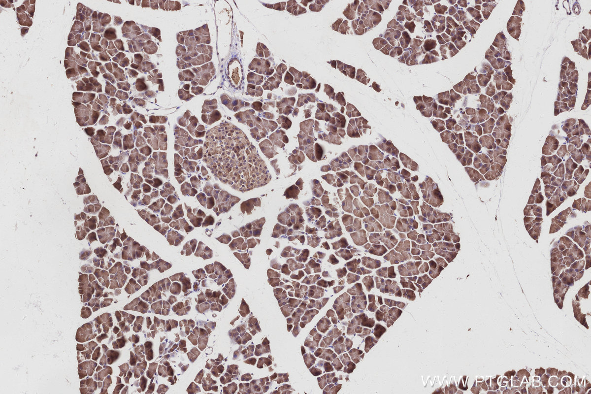 IHC staining of mouse pancreas using 24847-1-AP IHC staining of mouse pancreas using 24847-1-AP