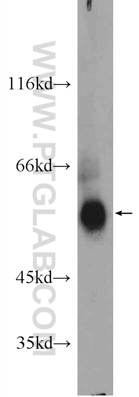 WB analysis of mouse brain using 24847-1-AP