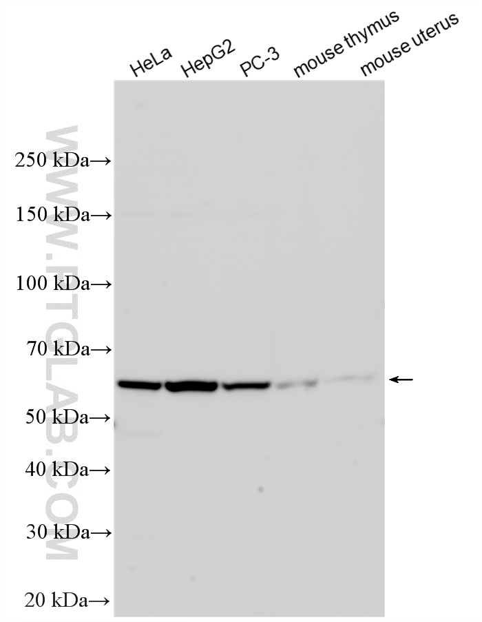 Various lysates were subjected to SDS PAGE followed by western blot with 24847-1-AP (KLHDC5 antibody) at dilution of 1:4000 incubated at room temperature for 1.5 hours. WB analysis using 24847-1-AP