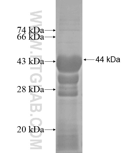 KLHL11 fusion protein Ag10821 SDS-PAGE KLHL11 fusion protein Ag10821 SDS-PAGE