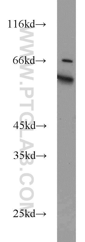 WB analysis of PC-3 using 14883-1-AP