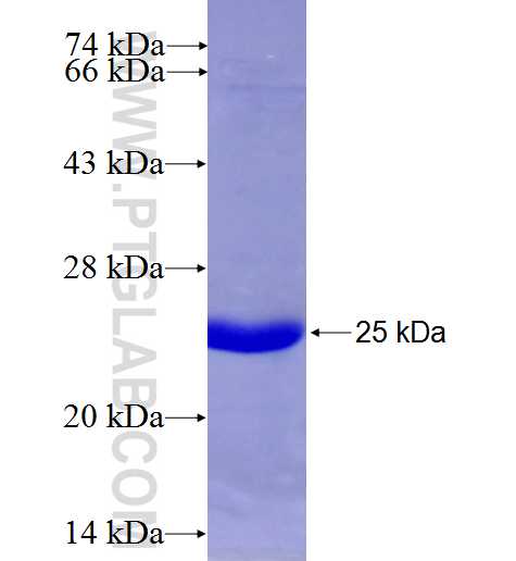 KLHL13 fusion protein Ag7878 SDS-PAGE