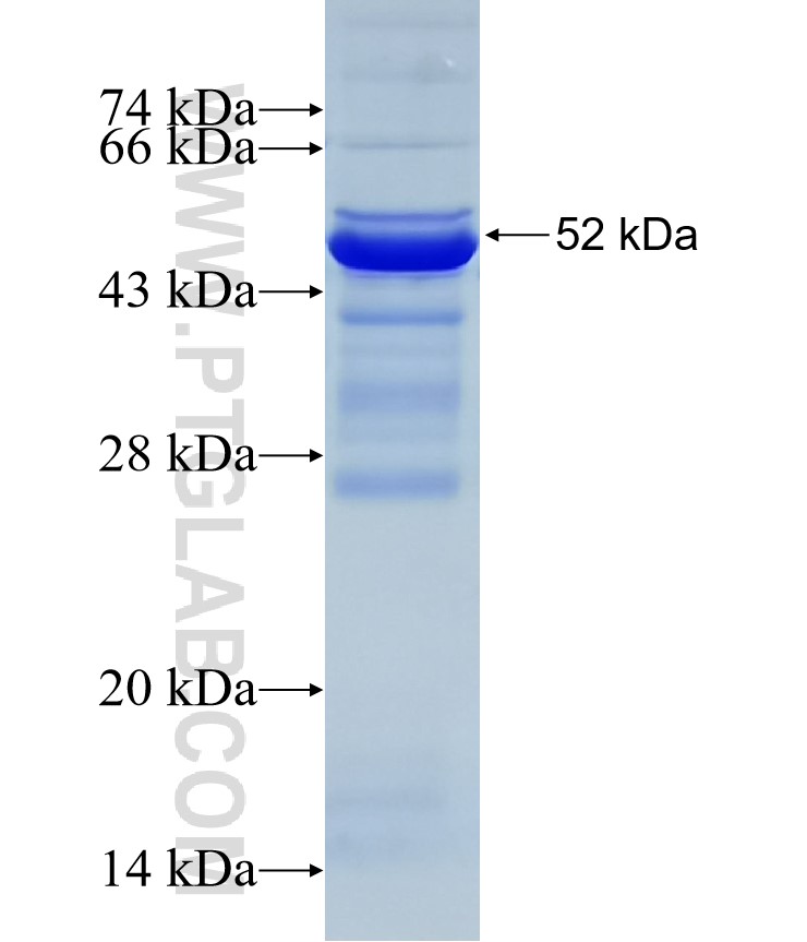 KLHL14 fusion protein Ag10065 SDS-PAGE