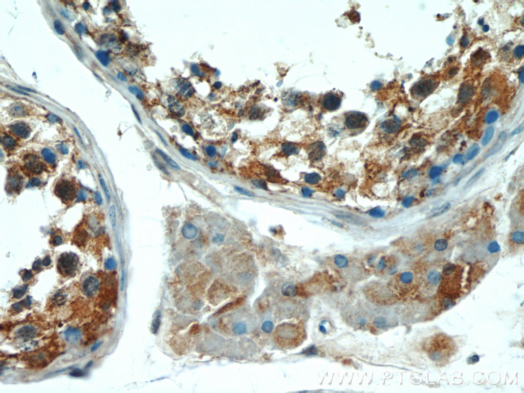 IHC staining of human testis using 25066-1-AP