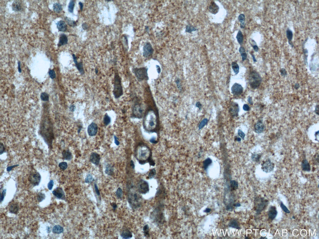 IHC staining of human brain using 25066-1-AP