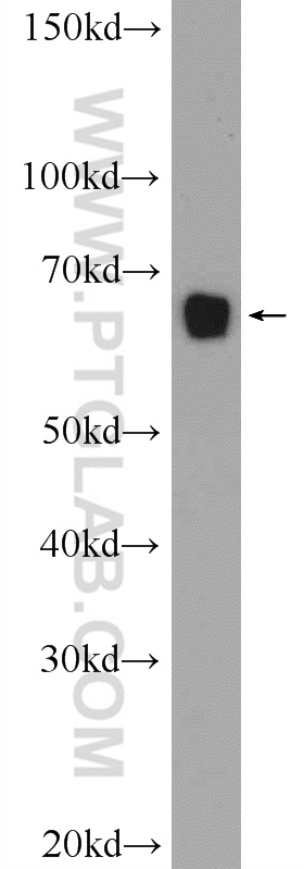 WB analysis of HeLa using 25066-1-AP