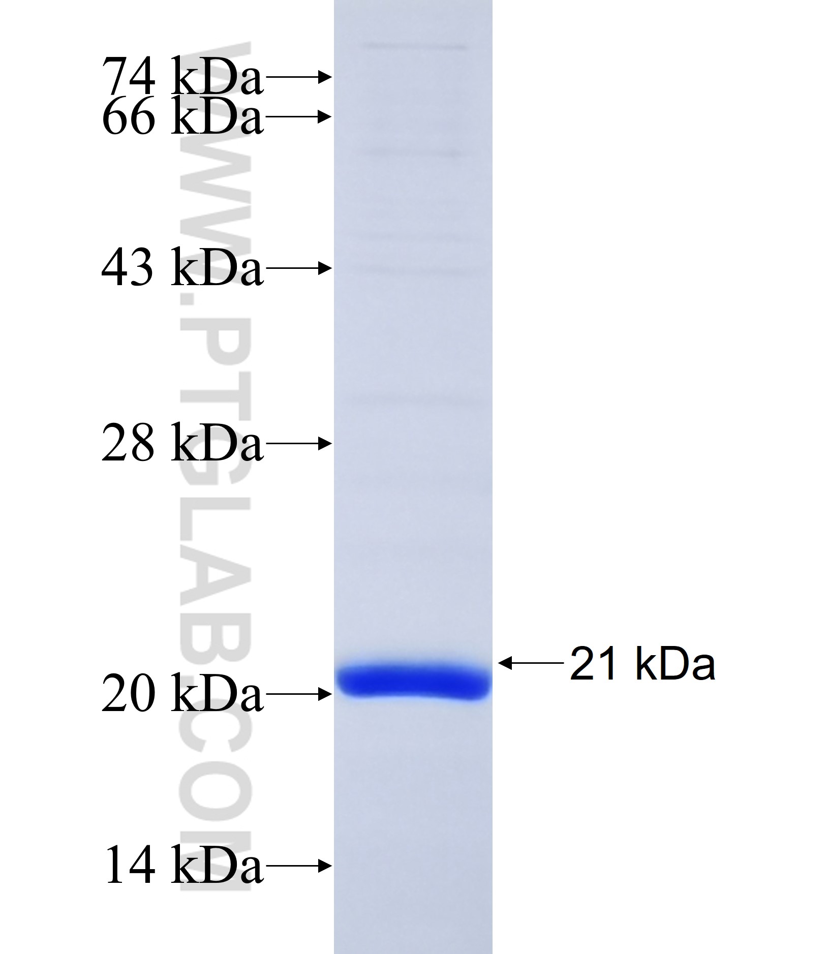 KLHL17 fusion protein Ag37183 SDS-PAGE KLHL17 fusion protein Ag37183 SDS-PAGE