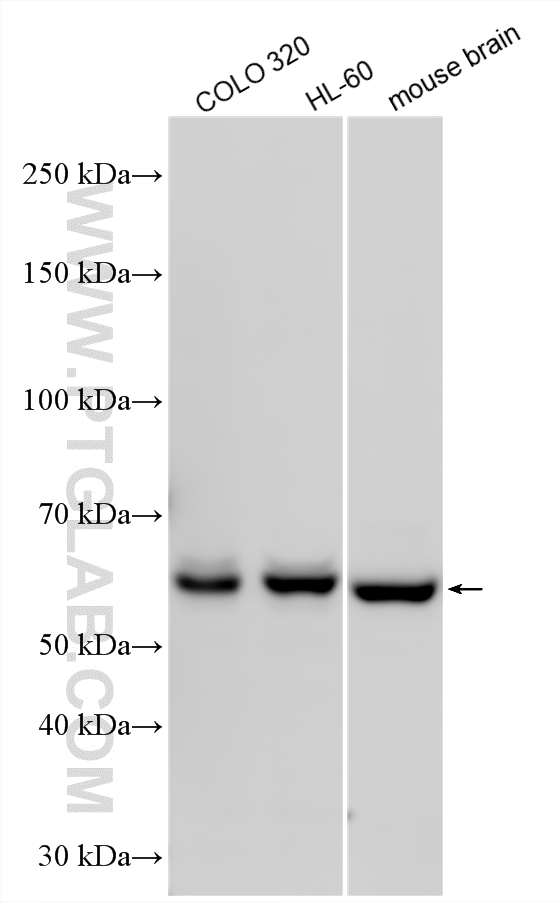 WB analysis using 17229-1-AP