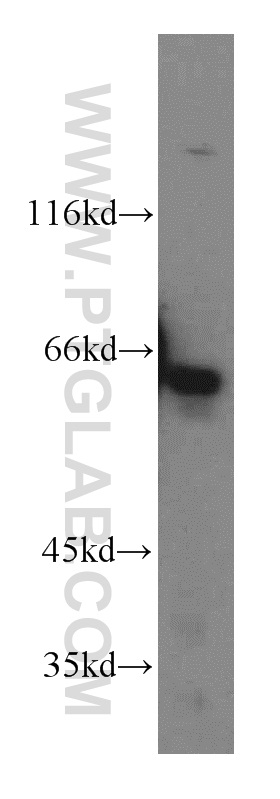 WB analysis of HepG2 using 17229-1-AP