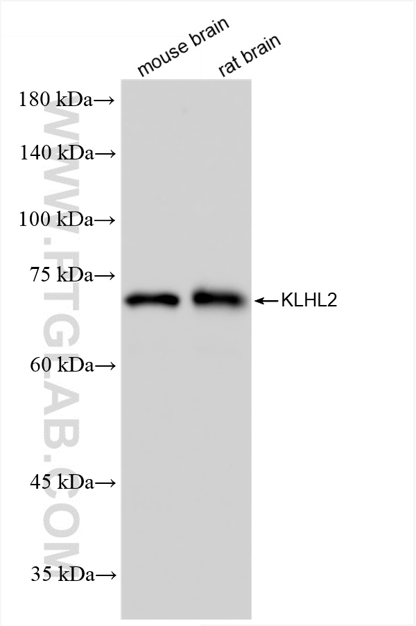 WB analysis using 85893-1-RR WB analysis using 85893-1-RR