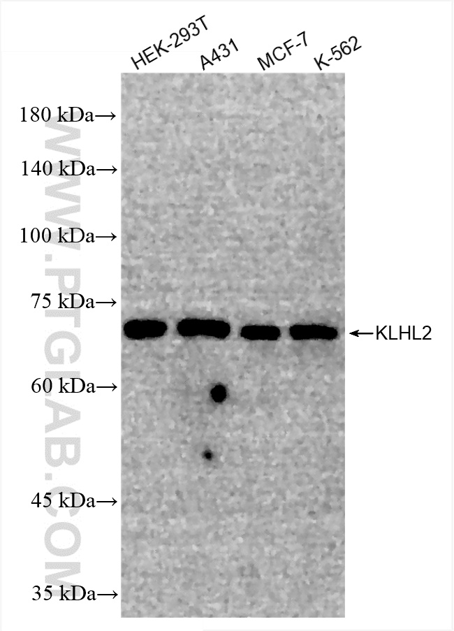 WB analysis using 85893-1-RR