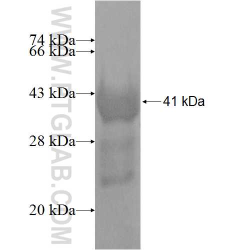 KLHL2 fusion protein Ag5950 SDS-PAGE