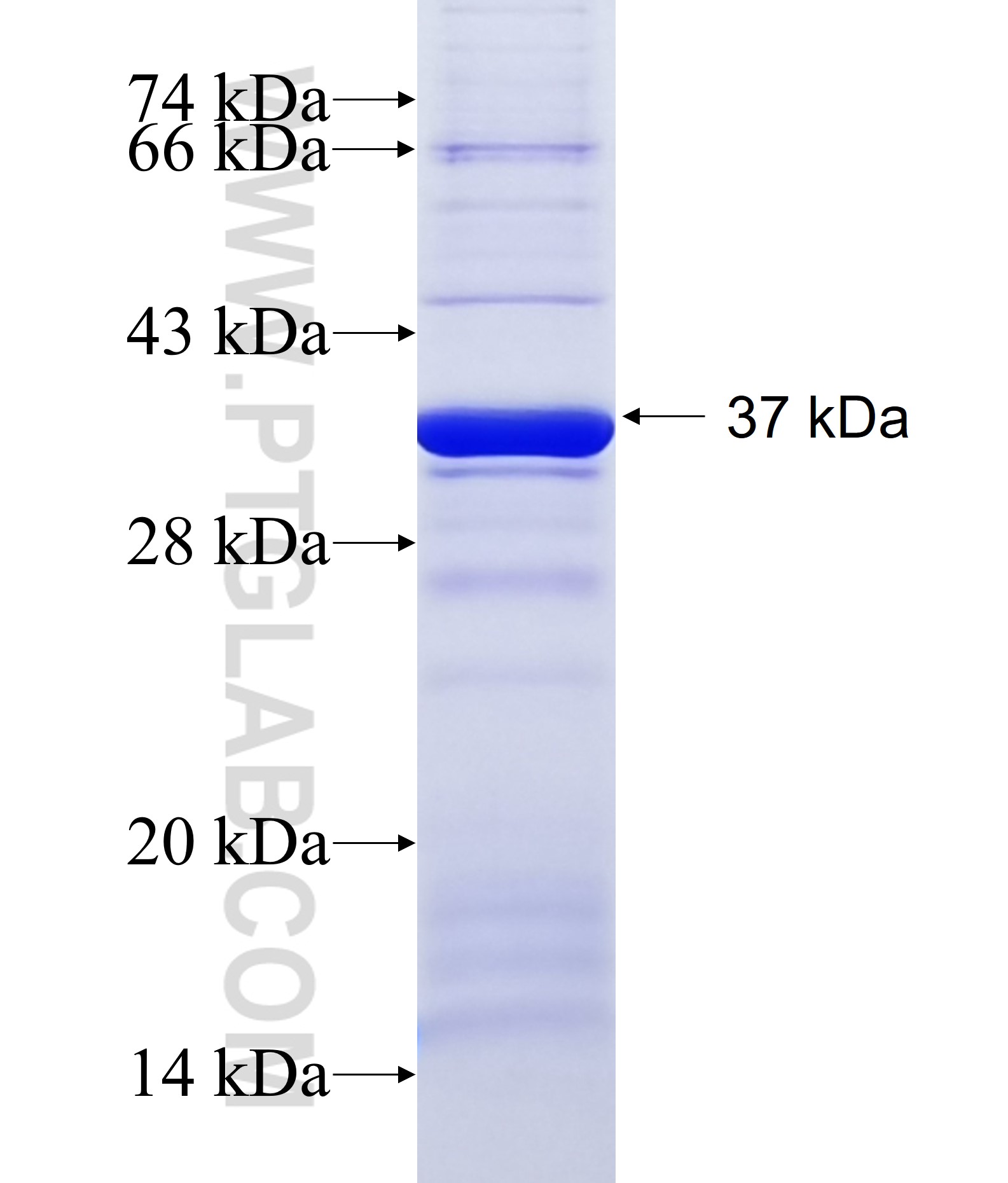 KLHL2 fusion protein Ag5950 SDS-PAGE