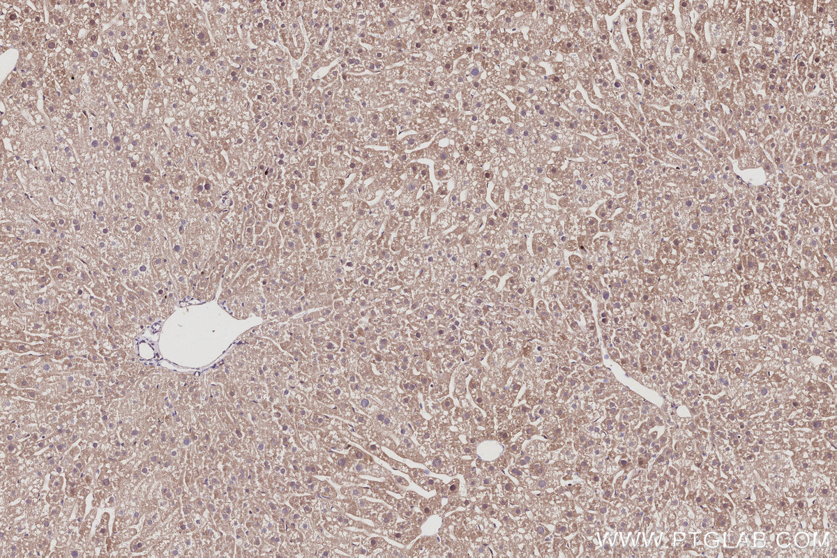 IHC staining of mouse liver using 16952-1-AP IHC staining of mouse liver using 16952-1-AP