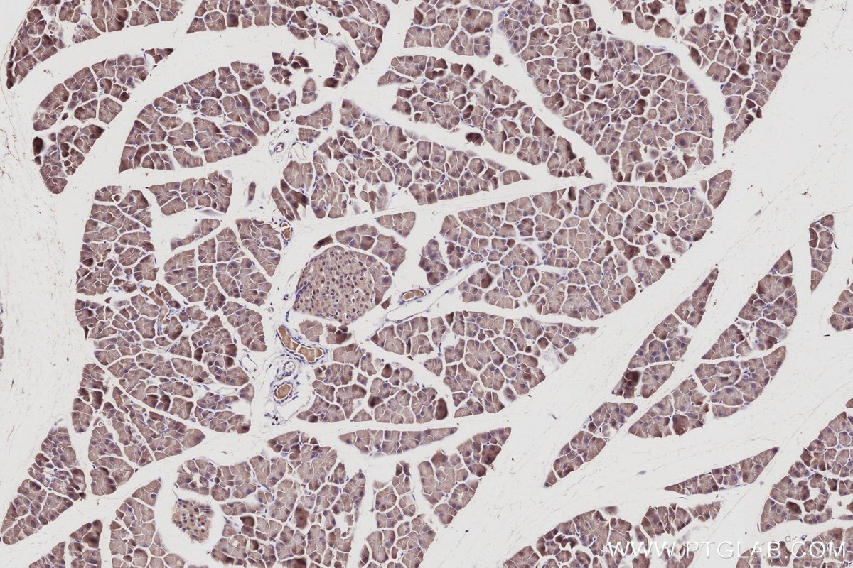IHC staining of mouse pancreas using 16952-1-AP IHC staining of mouse pancreas using 16952-1-AP