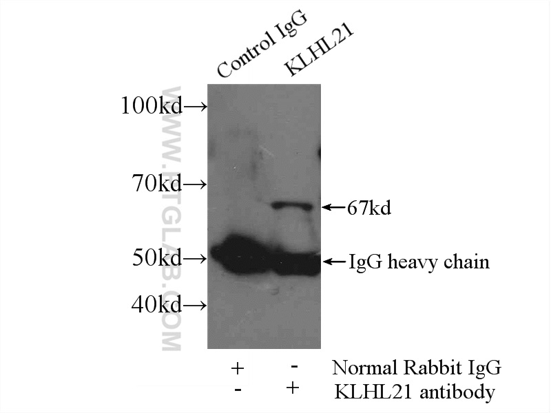 IP experiment of HeLa using 16952-1-AP