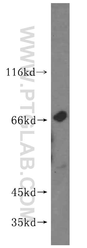 WB analysis of A431 using 16952-1-AP