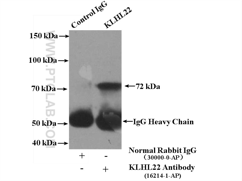 IP experiment of PC-3 using 16214-1-AP