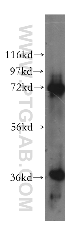 KLHL22