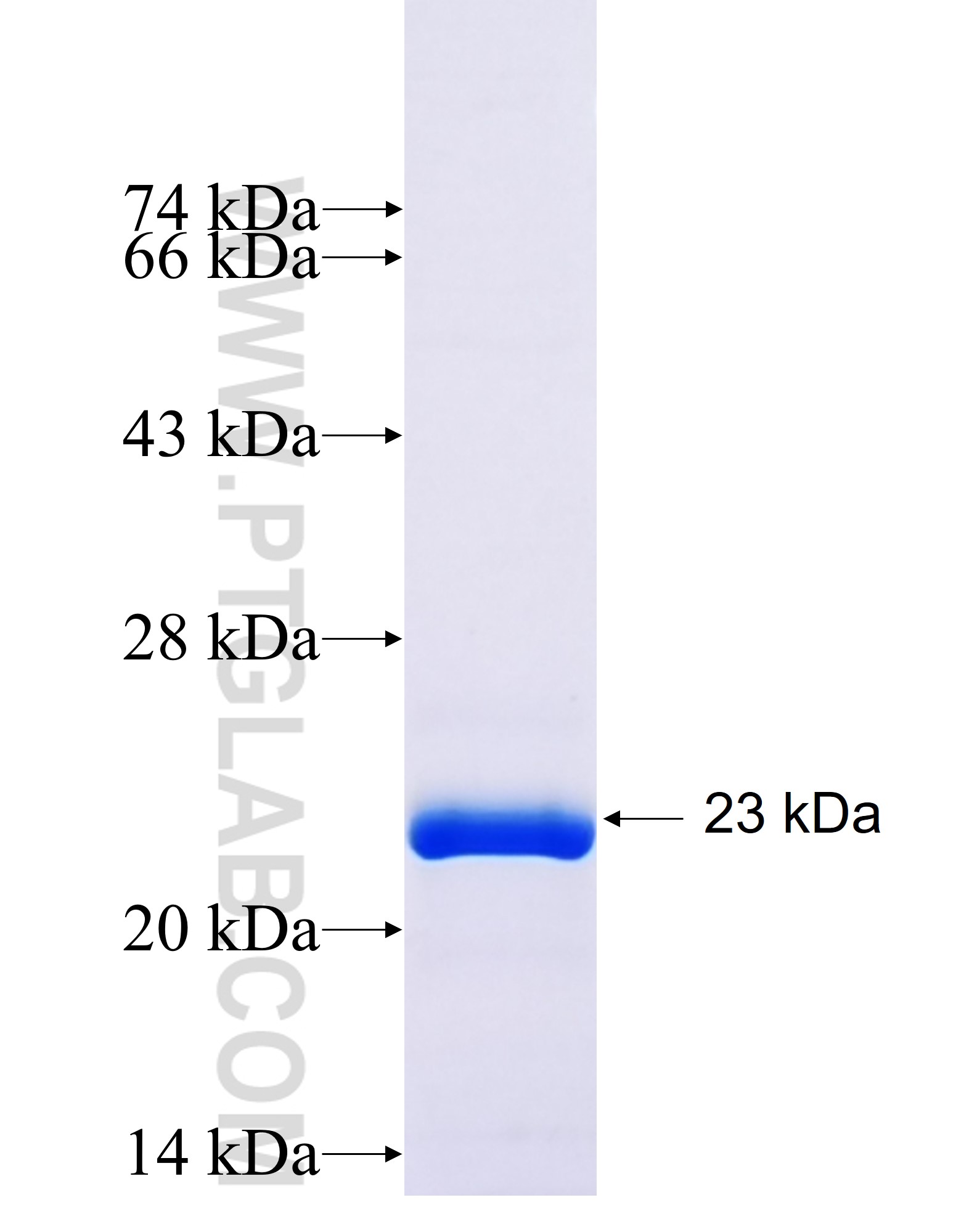 KLHL24 fusion protein Ag27199 SDS-PAGE